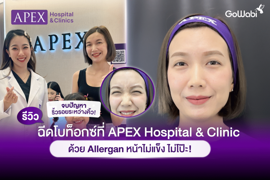 รีวิวฉีดโบท็อกซ์ APEX