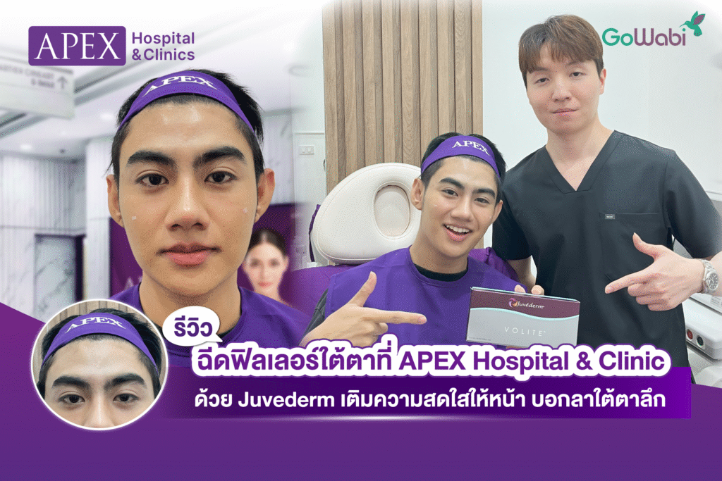 ฉีด juvederm ฟิลเลอร์ใต้ตา Apex รีวิว