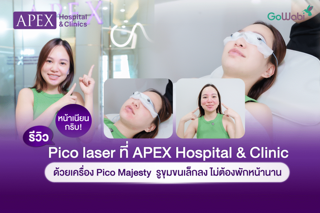 เลเซอร์ขน Apex รีวิวเลเซอร์ขน 3 พลังงาน