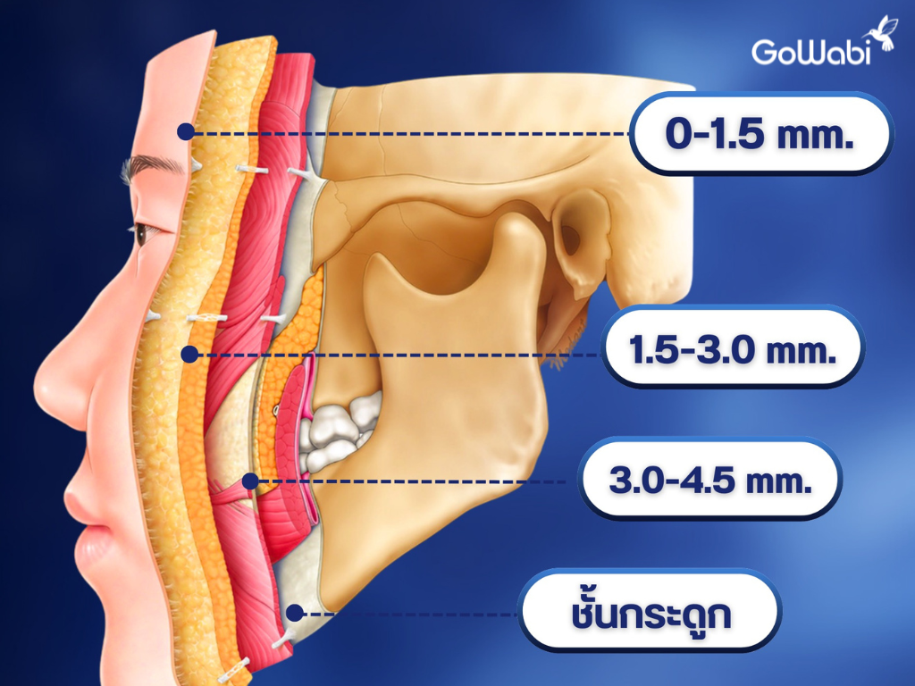 dr.j j-lift™ technique