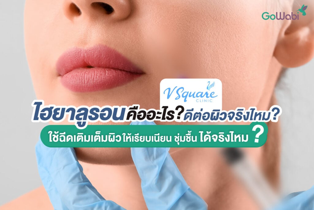 ไฮยาลูรอน