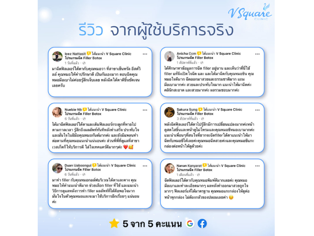 under-eye filler at v square review