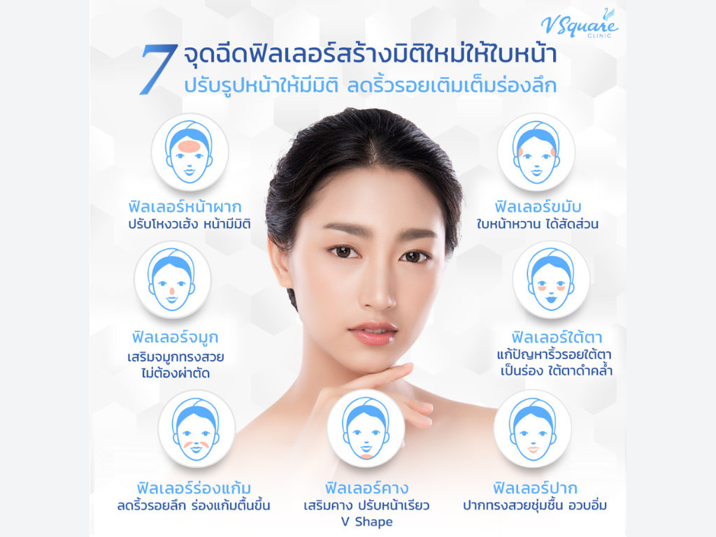 hyaluron filler ตำแหน่งที่นิยมฉีด