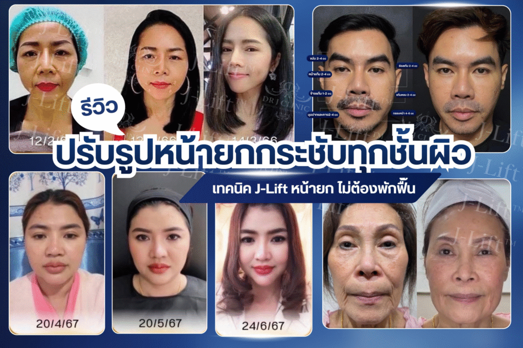 dr.J clinic รีวิว