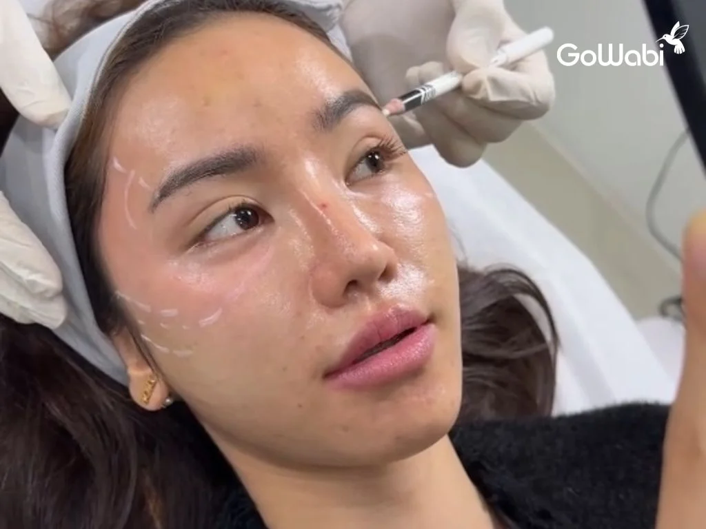 Dr.J Clinic การฉีด Therafill