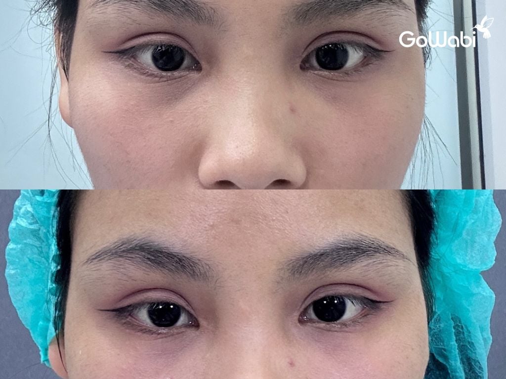 Dr.J Clinic ภาพเปรียบเทียบก่อนและหลังทำ