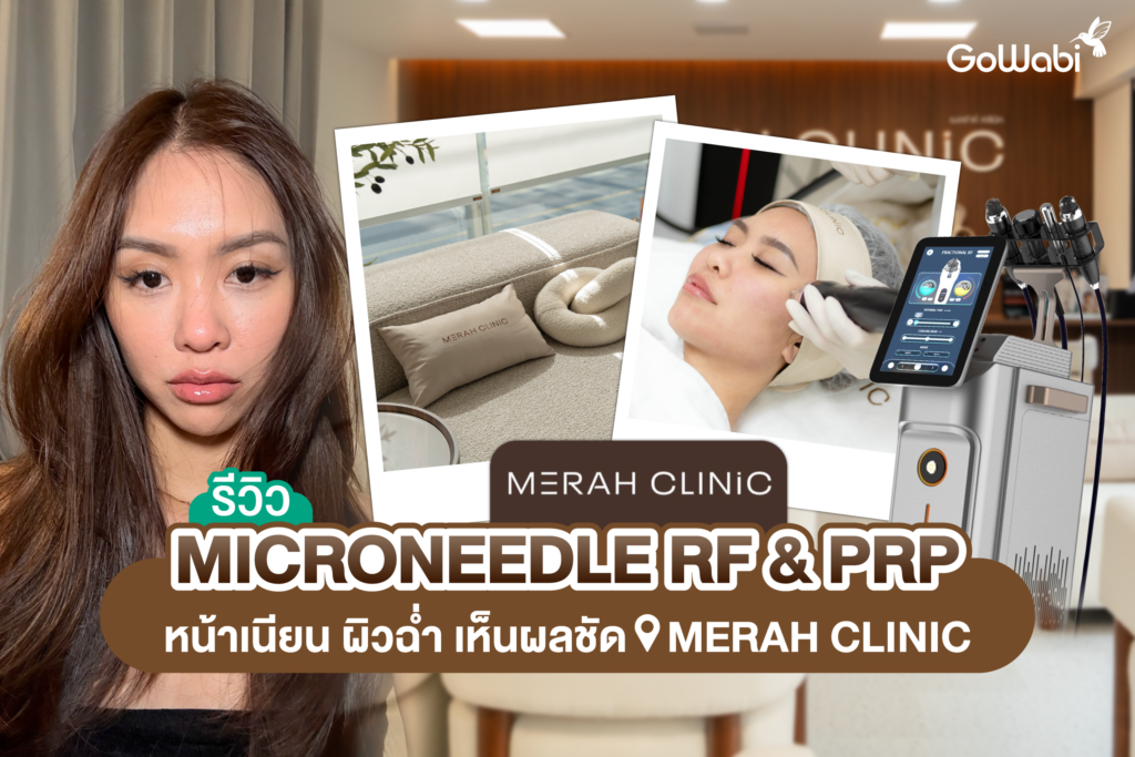 Merah Clinic รีวิว Microneedle RF และ PRP