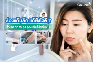 หัตถการแก้ไขร่องแก้มลึก