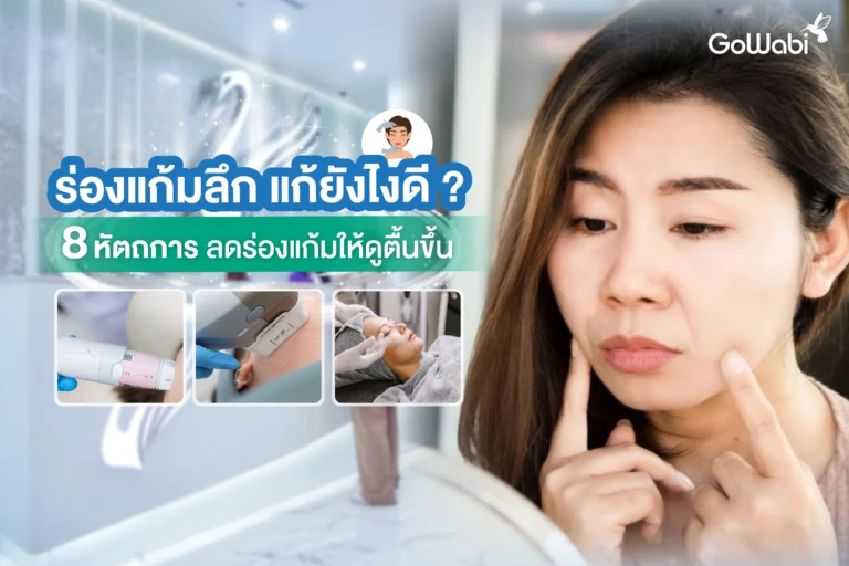 หัตถการแก้ไขร่องแก้มลึก