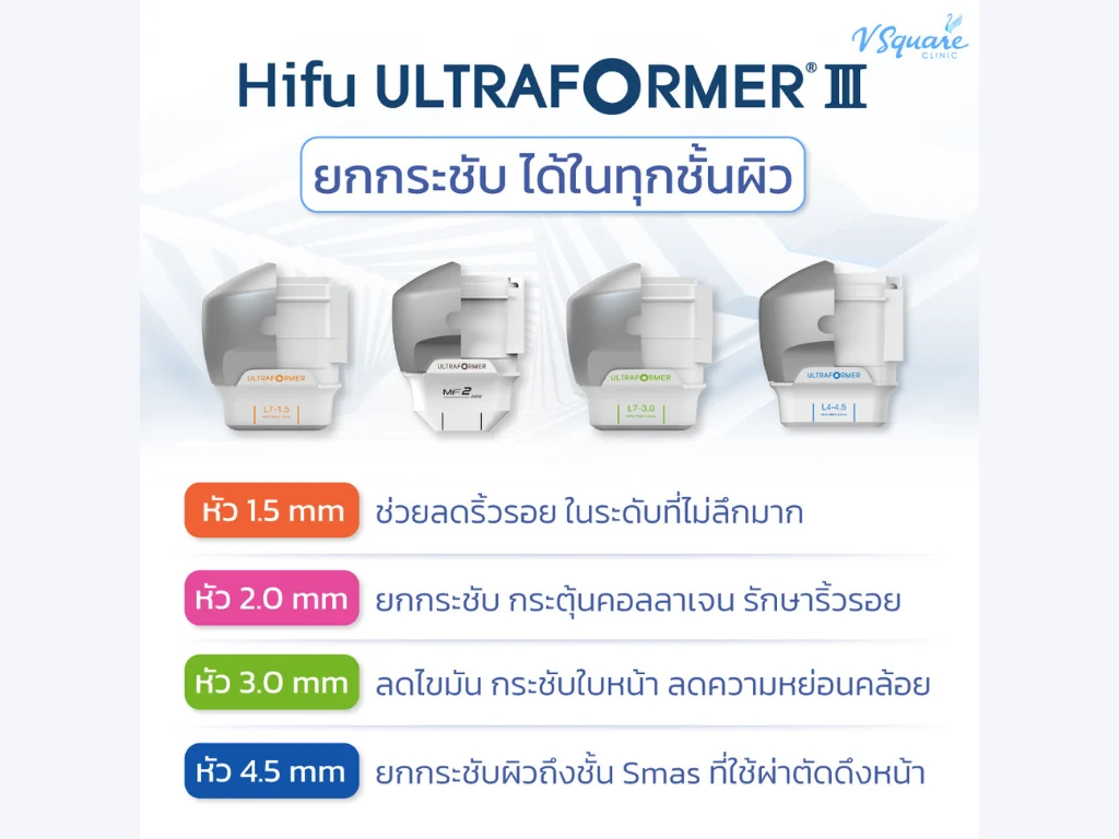 หัวยิง Ultraformer III