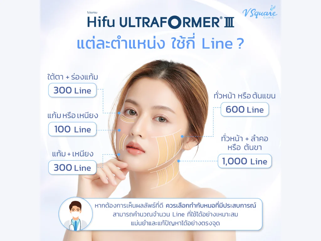 Ultraformer III ใช้กี่ไลน์