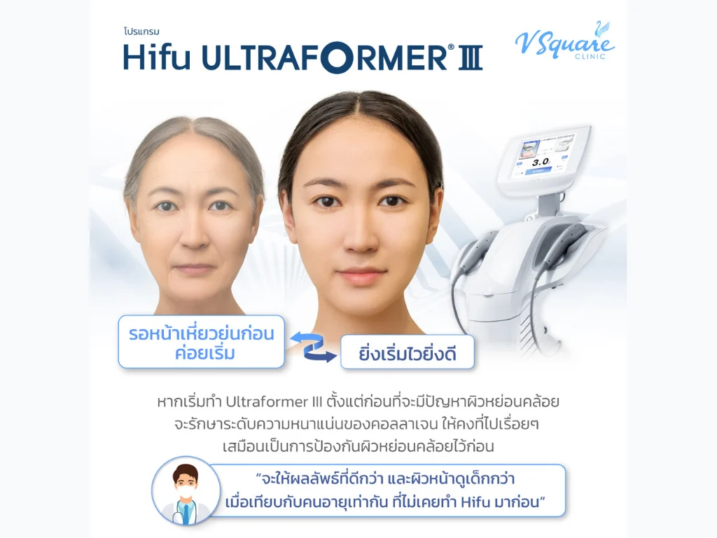 Ultraformer III ยิ่งทำไวยิ่งดี