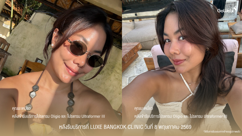 Luxe Bangkok Clinic รีวิว ภาพเปรียบเทียบก่อนและหลังเข้ารับบริการประมาณ 1 สัปดาห์